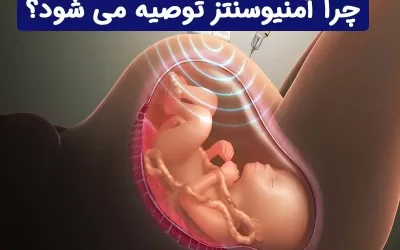 چرا آنالیز کروموزومی مایع آمنیون (آمنیوسنتز) توصیه می شود؟